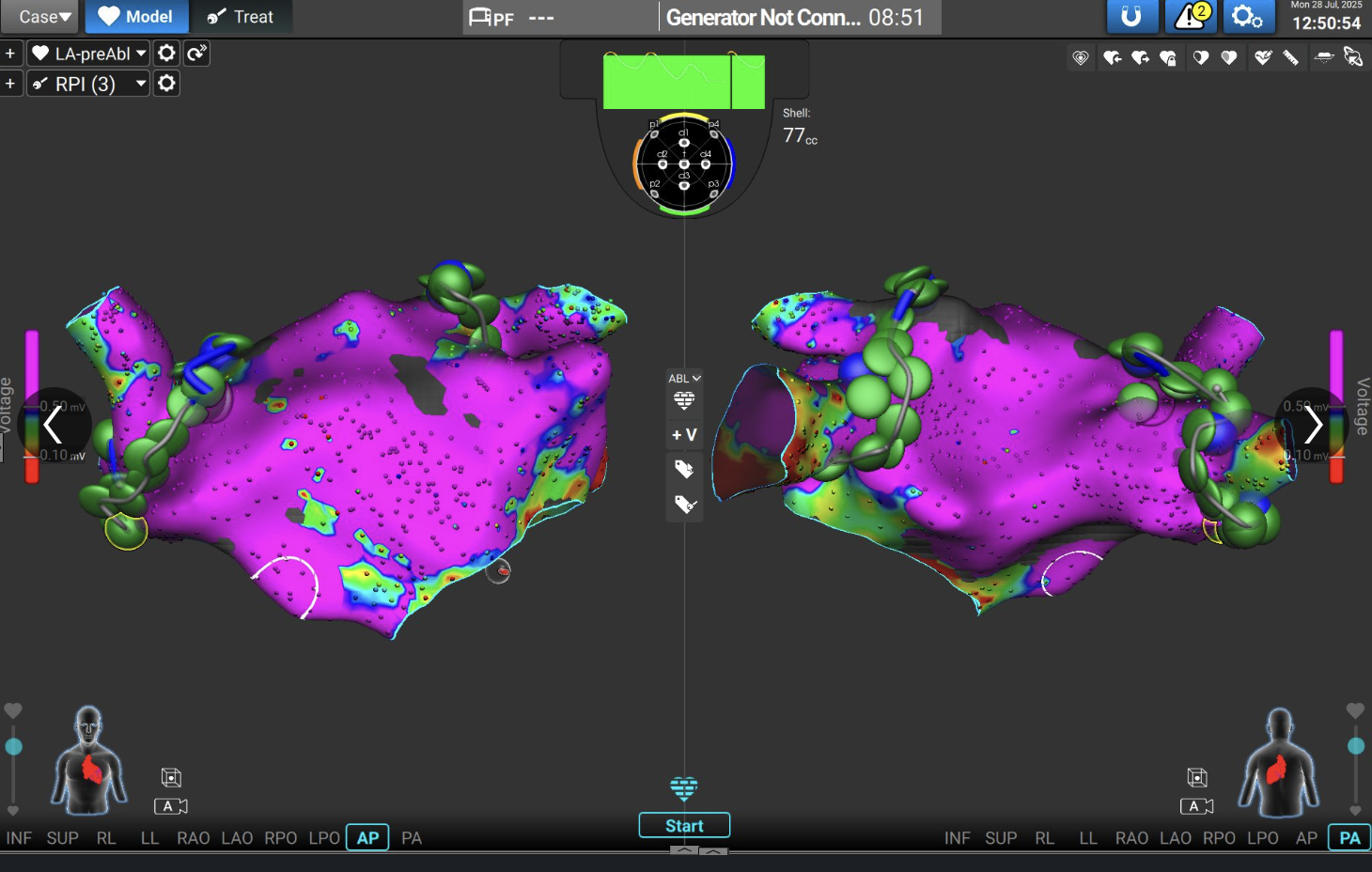 le mois du coeur hôpital de la tour